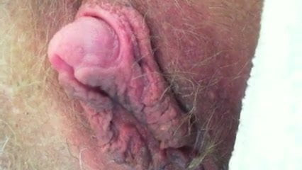 Huge clit