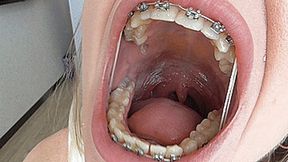 Big mouth with rubber bands! MP4