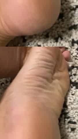 Solely feet and very close view for my consummate dry feet after baths