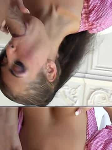 Delicate Anal
