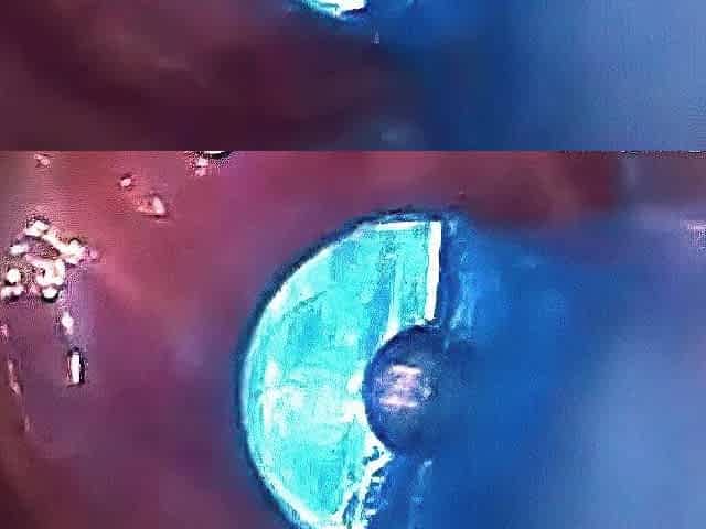 Endoscope POV: Test Tube Cock Urethral Insertion