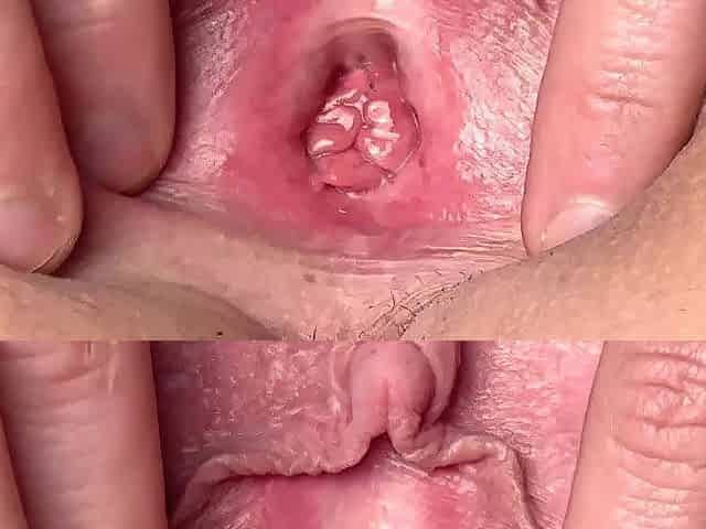 Close Up Widening My Cunt Wide