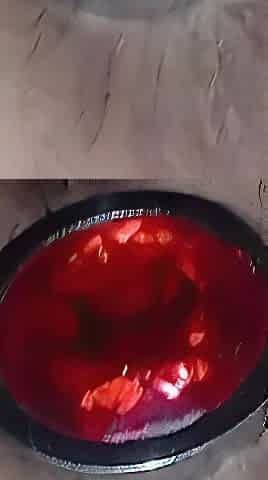 Anal Sex