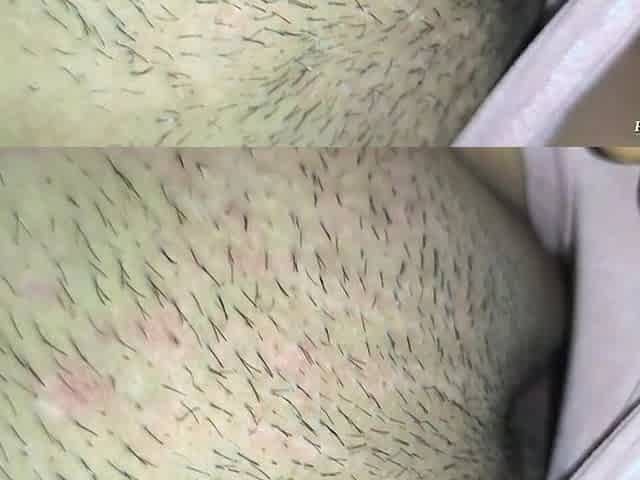 Anus Oil Massage Episode 1