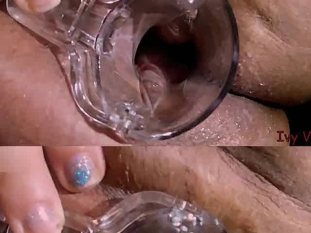 Speculum unfathomable inside my vagina