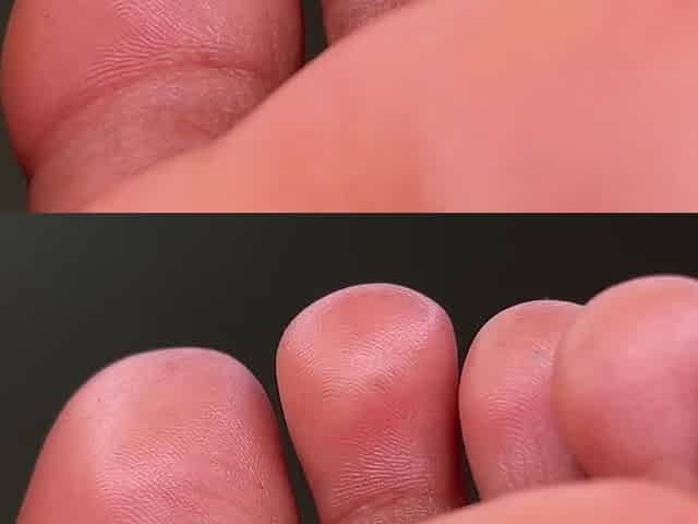 Wrinkly Toes up-close