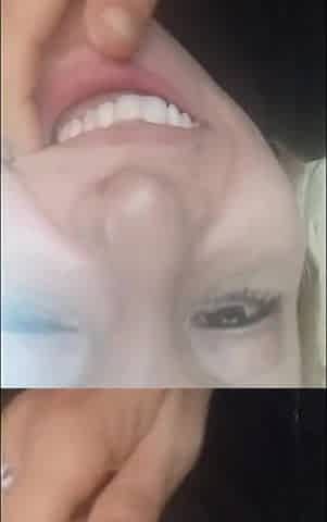 Beautiful Face, but Rotten Teeth!