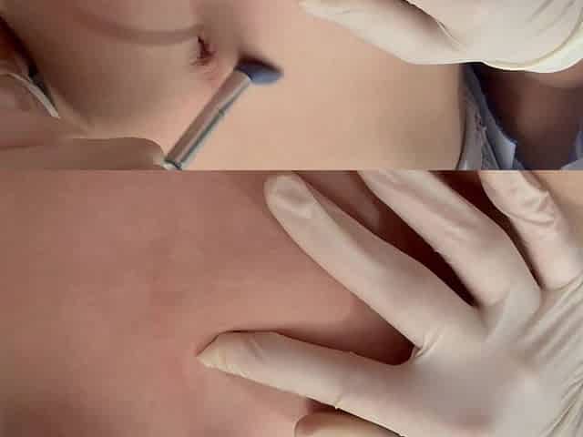 I Play with Medical Gloves Belly Button