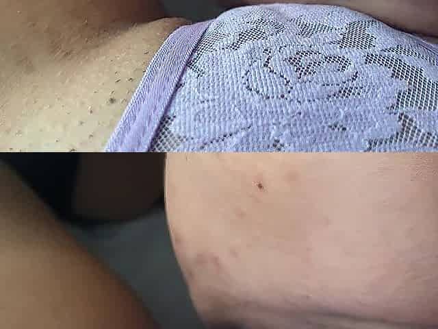 My lesbo most excellent ally makes me cum many times by sucking my huge clitoris