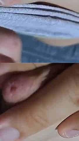 Nipples