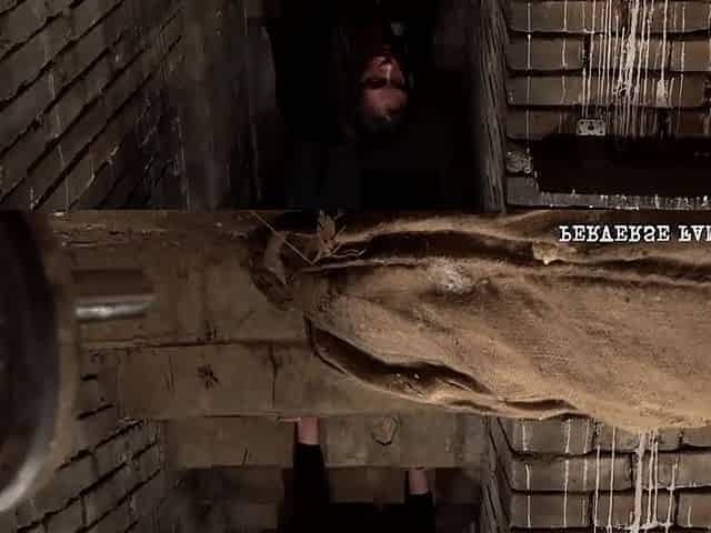 Anal Pumping Prolapse