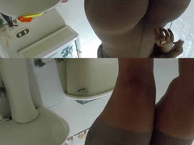 Camera Captures Patients and Nurses Pissing in Dr. Amor's Clinic