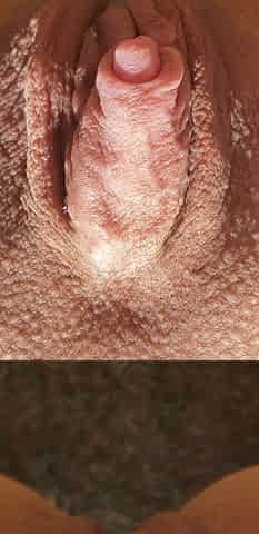 My big clit