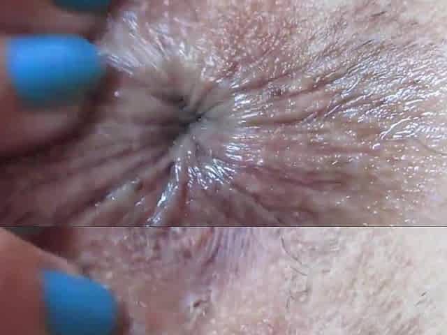 close up anal