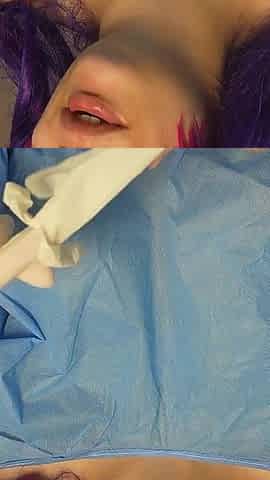 The Evil Doctor S Secret a Circumcising Procedure
