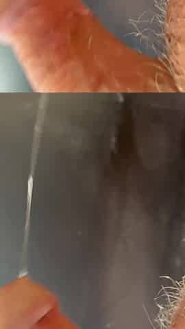 Bulbourethral fluid draining from my flabby jock