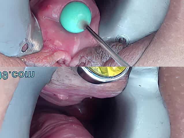 Stim99’s peehole brutally fucked with huge dildo