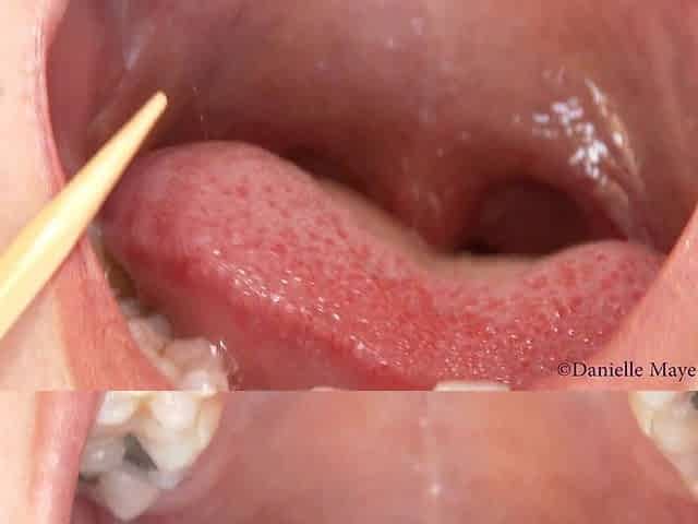 Exploring Danis Mouth Tongue Throat