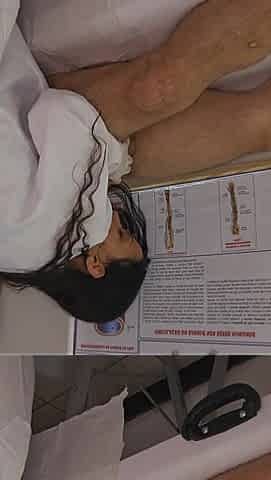 Nurse Observes Patient's Erection