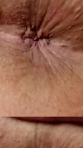 Asshole Close up Winking
