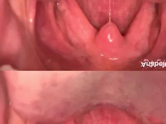 Uvula Fetish