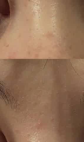Come Look Into My Eyes Because I Have an Eye Fetish and I'll Show You My Eyes up Close