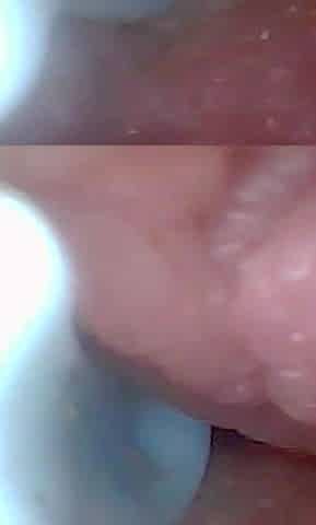 Let's Take a Peek Into My Juicy Pussy Together (endoscope Camera)