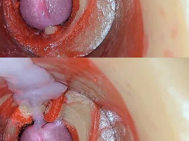 Female Insemination - Inward Camera Captures Unfathomable Hunk Giant Jizz flow