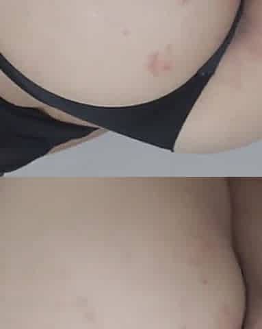 Skinny Girl with Braces Licking My Ass!
