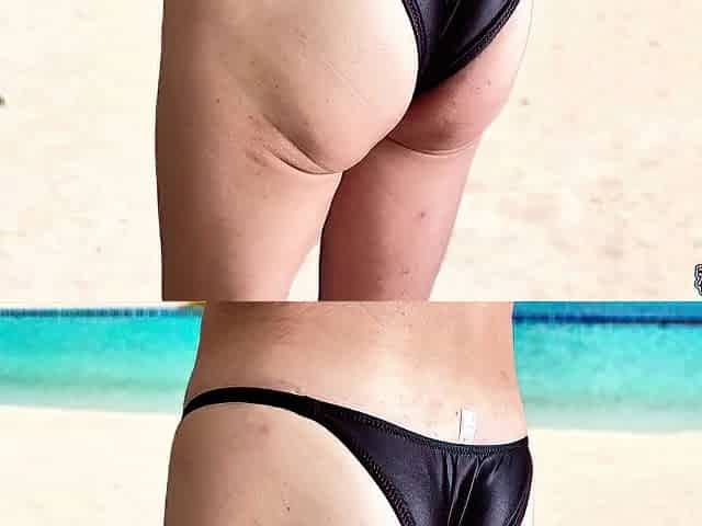 I sunbathed in a small bikini. SecretGakuen