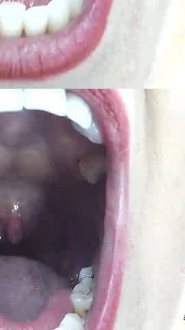 Inside My Big Mouth Tongue Teeth Uvula
