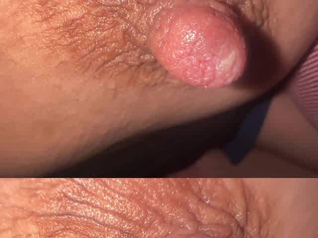 Nipples 7
