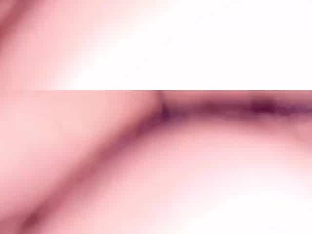 .....