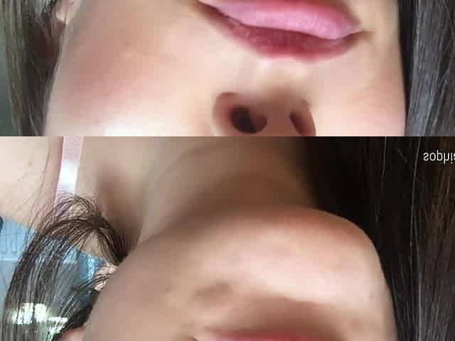Tongue and Yawn Teaser