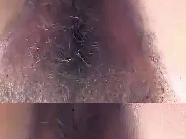 Blonde and Brunette Hairy Girls on Webcam Masturbating