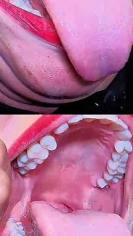 Uvula Fetish
