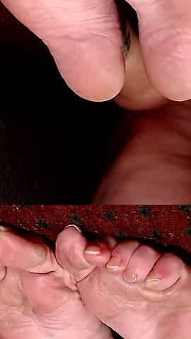 Curled up Feet Soles Wrinkled
