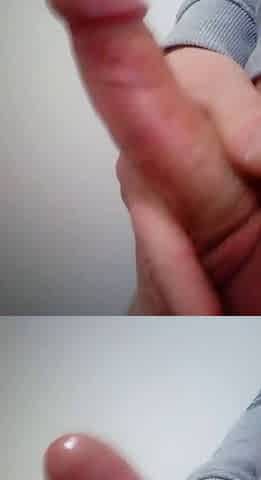 Dick