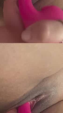 Vagina Fillers