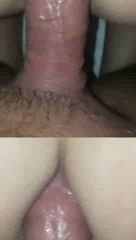 Anal