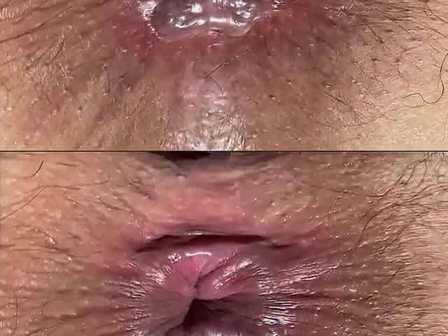 Unshaved booty in close-up 4K, all the hairs are visible. Anal aperture, screwed by frequent ass slam. Part two