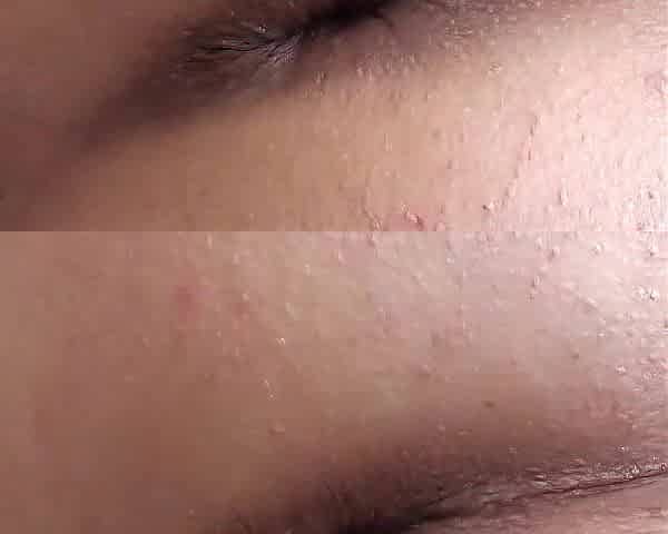 coarse anal fun