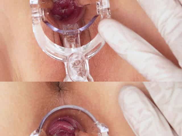 Uterus/cervix, Look How I Am Inside! Extreme Close-up