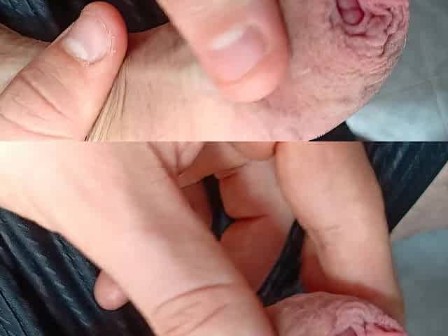 taut foreskin big dick play- playing with my uncut foreskin phimosis weenie