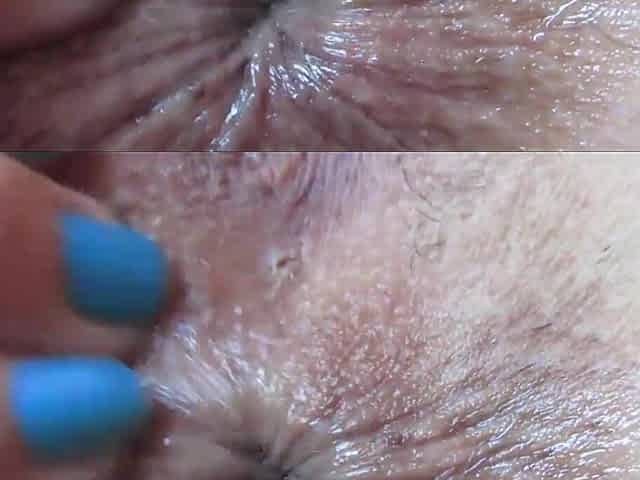 close up anal