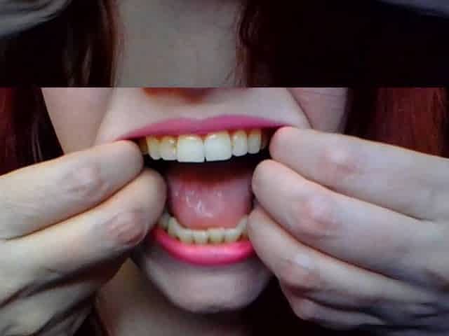 Teeth, Fillings & Mouth Fetish