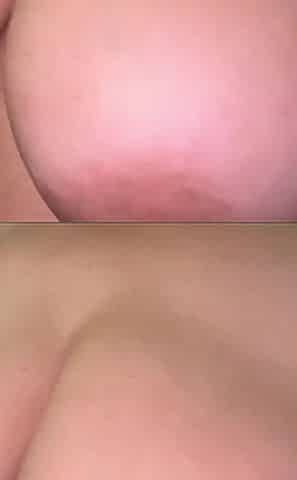 Tits!