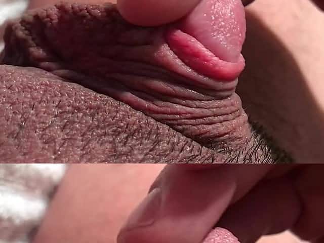 Foreskin Tease