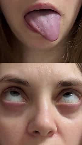 Ahegao