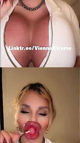 Goon on the massive injected Bimbo Lips